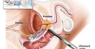 Foto 1 do Conto erotico: Exame à Próstata