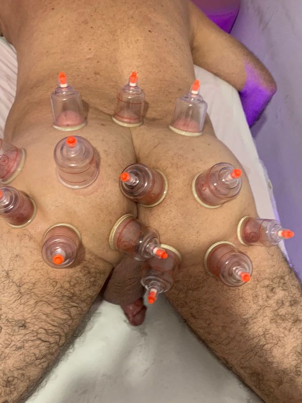 Foto 1 do Conto erotico: Massagem com ventosas