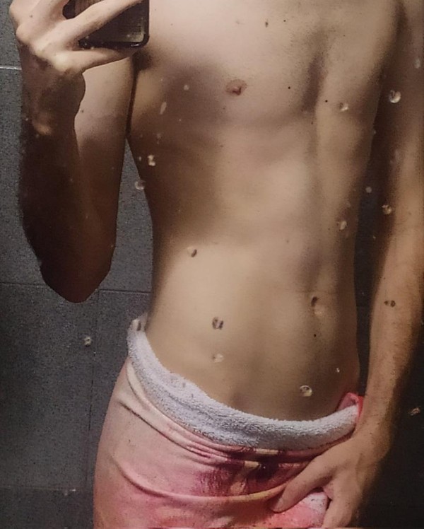 Foto 2 do Conto erotico: Caí de bike e meu amigo novinho cuidou de mim