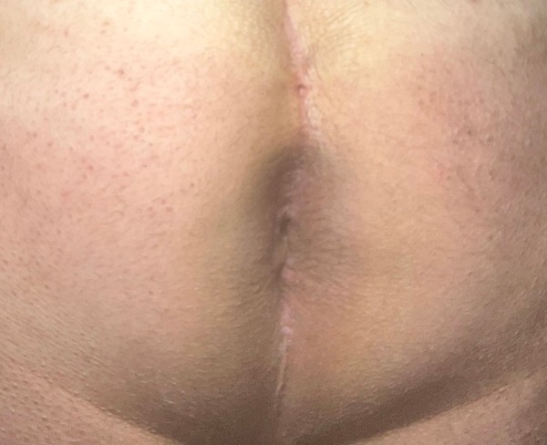 Foto 1 do Conto erotico: Após a Primeira vez! - parte 2