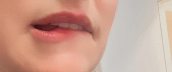 Foto 2 do Conto erotico: Safadezas com minha dentista casada