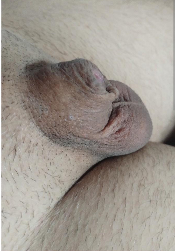 Foto 1 do Conto erotico: Praia de nudismo