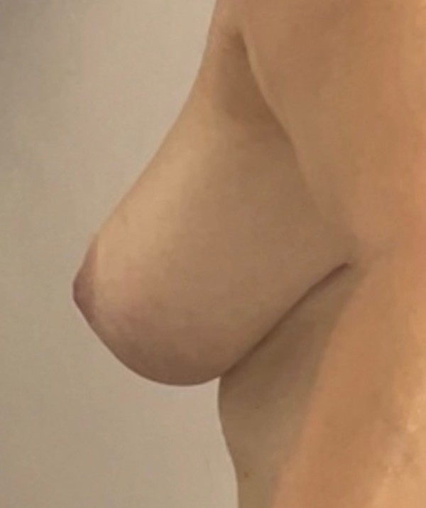 Foto 1 do Conto erotico: Seios de fora na live