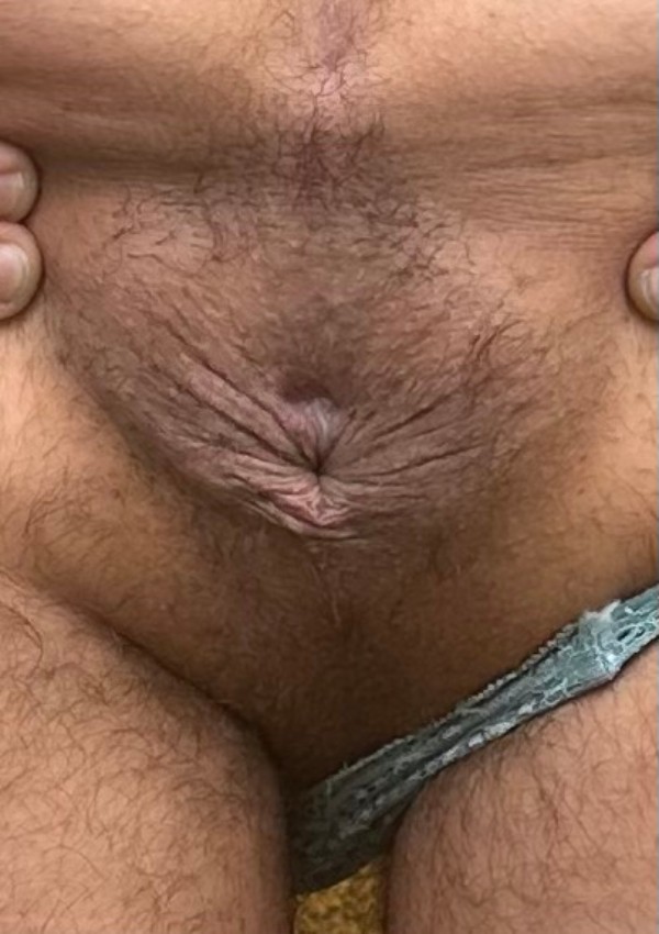 Foto 2 do Conto erotico: Meu médico tarado 1