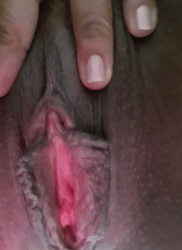 Foto 3 do Conto erotico: A ENFERMEIRA DA MINHA VÓ CUIDOU DO MEU MARIDO