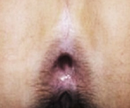 Foto 2 do Conto erotico: ANAL...O PRAZER PARA POUCAS!